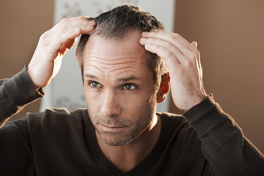 7 Tipps, wie Männer mit Haarverlust umgehen können