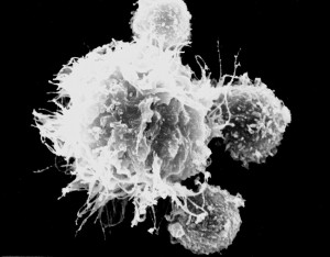 Dendritische Zellen (groß) spielen eine Schlüsselrolle bei Krebsimpfungen: Sie lenken den Angriff des Immunsystems auf den Tumor, indem sie den T-Killerzellen ein Fahndungsbild der Tumorzellen präsentieren. Quelle: DKFZ/Markus Feuerer
