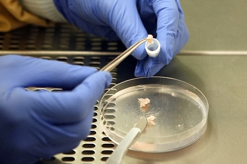 Erste erfolgreiche Retransplantation von eingefrorenem Eierstockgewebe © dpa - Report