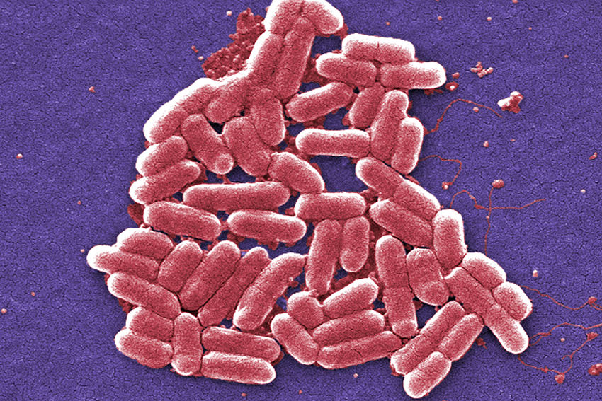 Vor allem Darmbakterien wie Escherichia coli sind immer häufiger resistent gegen Antibiotika. © picture alliance/AP Photo