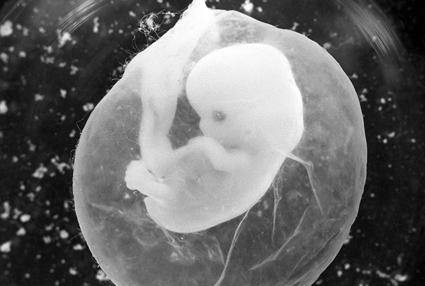 Bild eines sieben Wochen alten Fötus in der Fruchtblase. Er dürfte nach deutschem Recht abgetrieben werden. © dpa