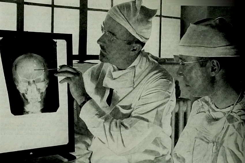 Dr. Walter Freeman (links) und Dr. James W. Watts bereiten sich gerade auf eine Lobotomie vor. © pl.wikipedia.org