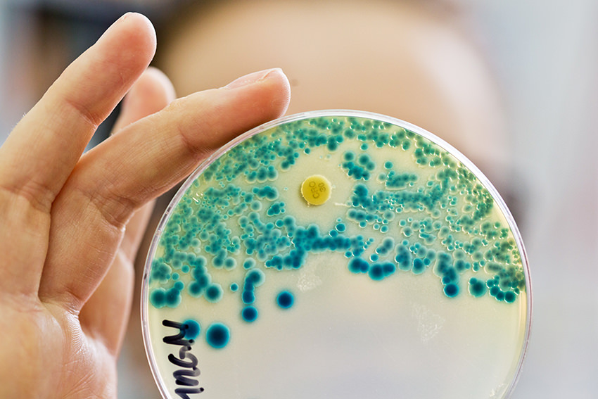 WHO drängt zum Kampf gegen Antibiotika-Resistenzen 