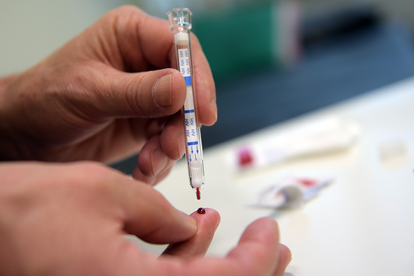HIV-Tests vielleicht bald für zu Hause